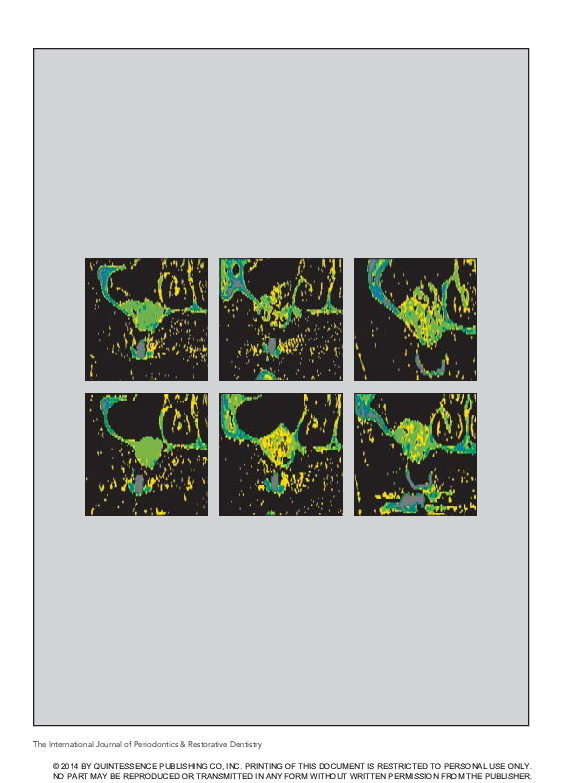 (PDF) Radiographic comparison of different concentrations of ...