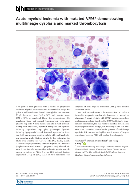 (PDF) Acute myeloid leukemia with mutated NPM1 demonstrating ...