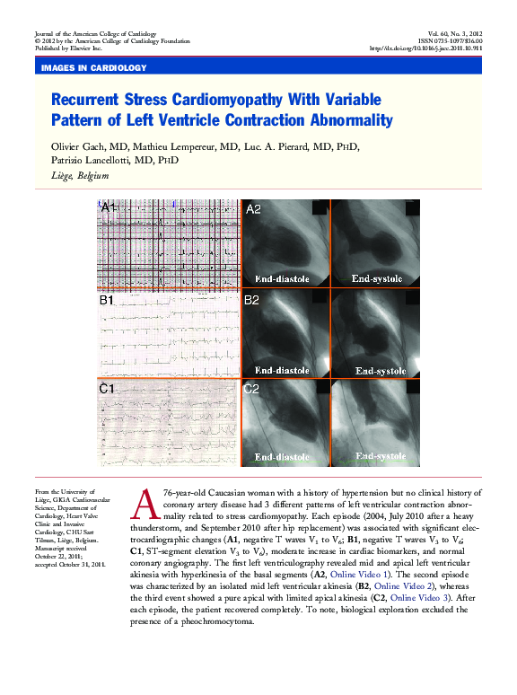 (PDF) Recurrent Stress Cardiomyopathy With Variable Pattern of Left ...