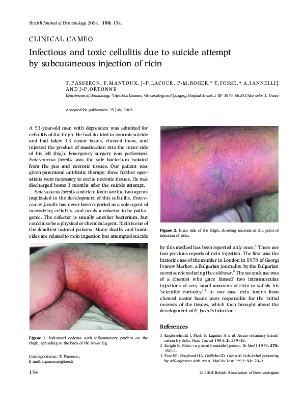 (PDF) Infectious and toxic cellulitis due to suicide attempt by ...