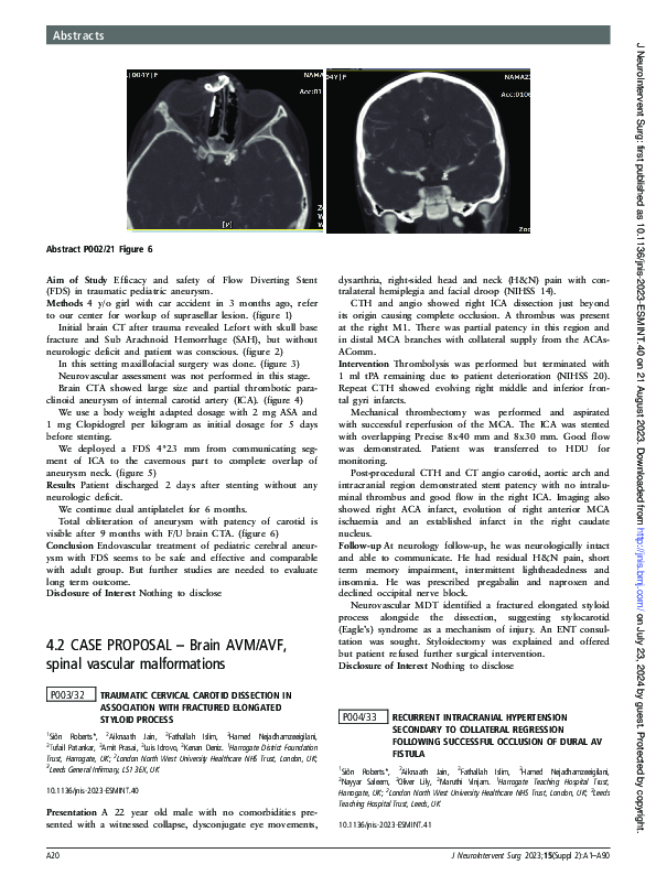 (PDF) P003/32 Traumatic cervical carotid dissection in association with ...