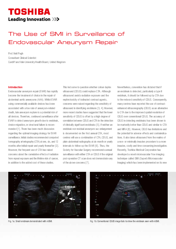 (PDF) The use of SMI in surveillance of endovascular aneurysm repair (EVAR)