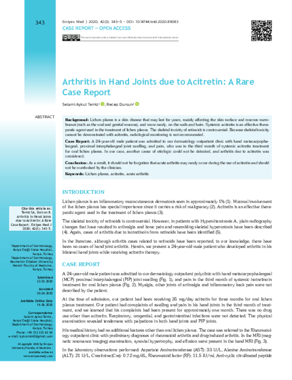 (PDF) Arthritis in hand joints due to acitretin: a rare case report