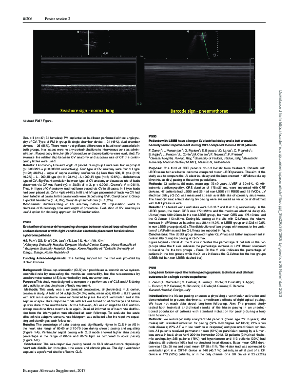 (PDF) P990Patients with LBBB have a longer LV electrical delay and a ...