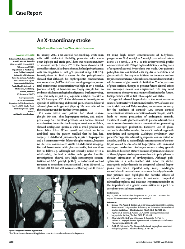 (PDF) An X-traordinary stroke | Diana Lewis - Academia.edu