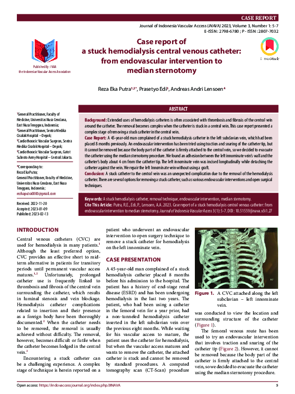 (PDF) Case report of a stuck hemodialysis central venous catheter: from ...