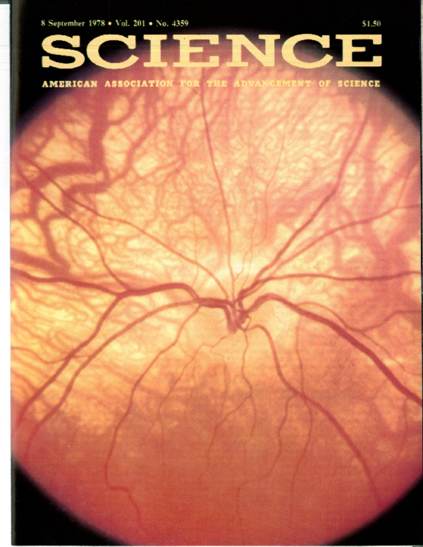 (PDF) Visual system anomalies in human ocular albinos.