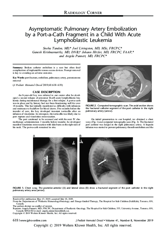 (PDF) Asymptomatic Pulmonary Artery Embolization by a Port-a-Cath ...