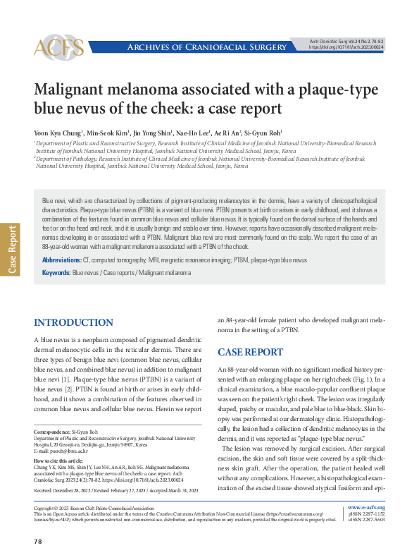 (PDF) Malignant melanoma associated with a plaque-type blue nevus of ...