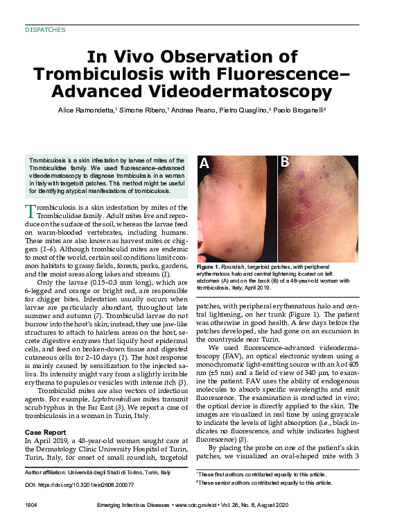 (PDF) In Vivo Observation of Trombiculosis with Fluorescence–Advanced ...
