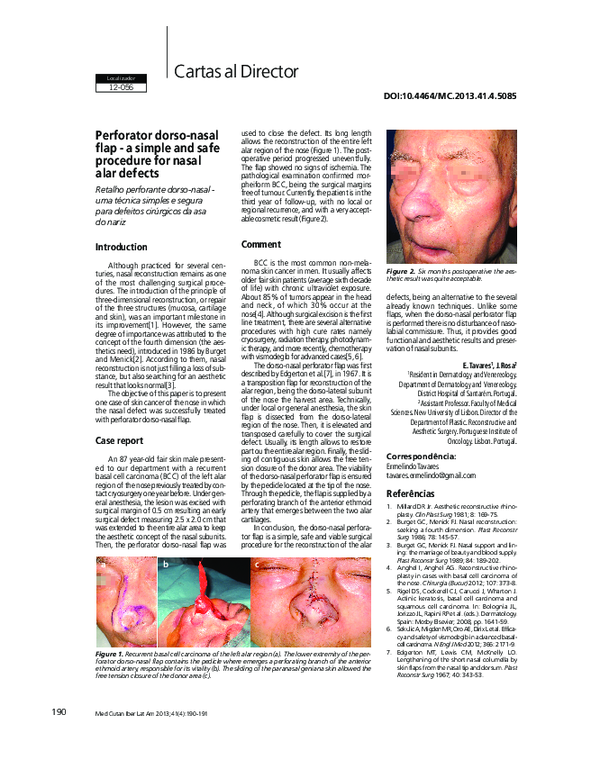 (PDF) Perforator dorso-nasal flap - a simple and safe procedure for ...