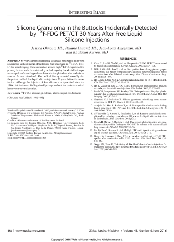 (PDF) Silicone Granuloma in the Buttocks Incidentally Detected by 18F ...
