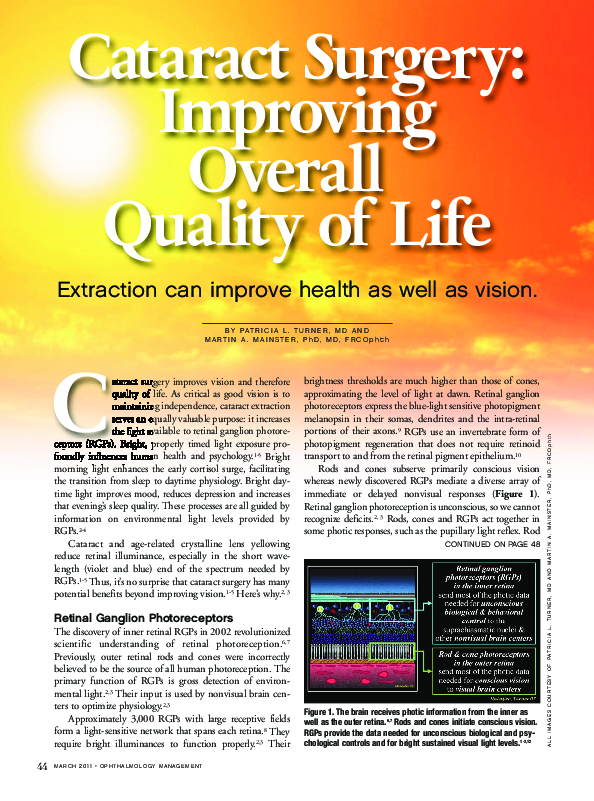 (PDF) Cataract Surgery: Improving Overall Quality of Life