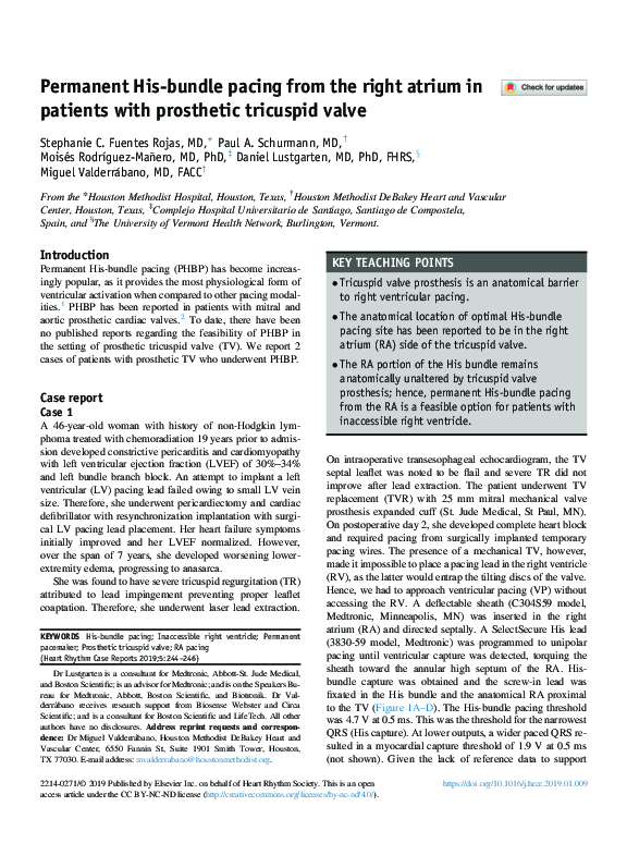 (PDF) Permanent His-bundle pacing from the right atrium in patients ...