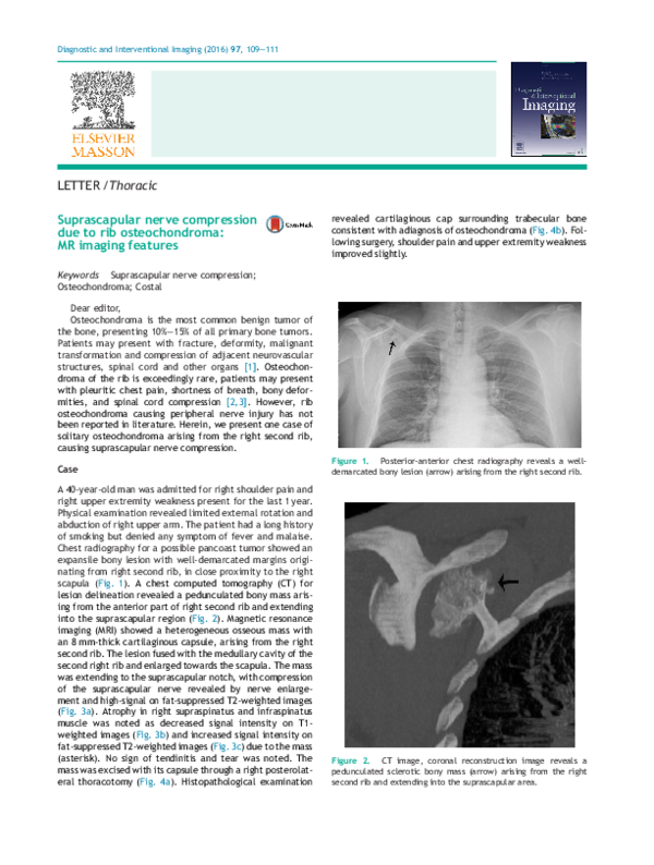 (PDF) Suprascapular nerve compression due to rib osteochondroma: MR ...