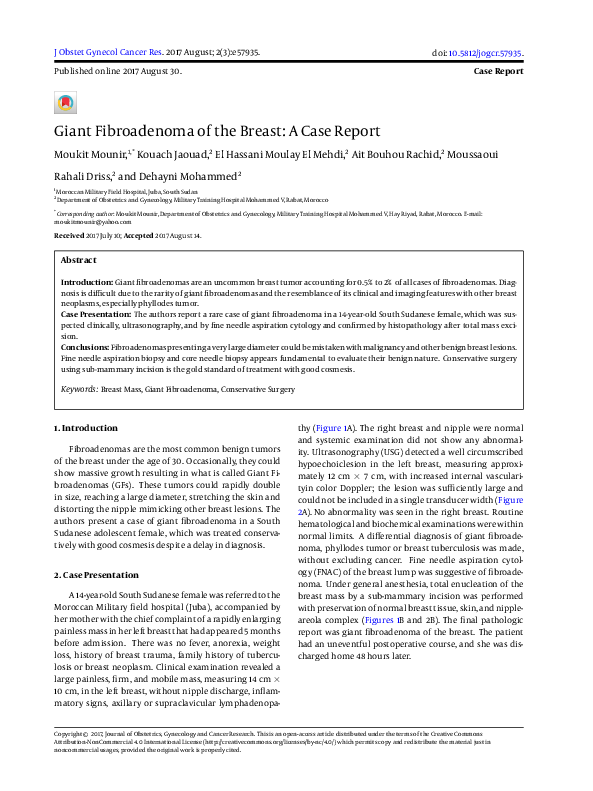 (PDF) Giant Fibroadenoma of the Breast: A Case Report