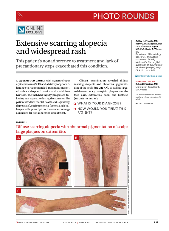 (PDF) Extensive scarring alopecia and widespread rash