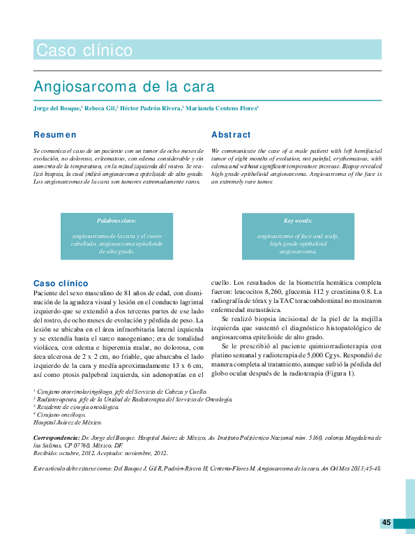 (PDF) Angiosarcoma of face