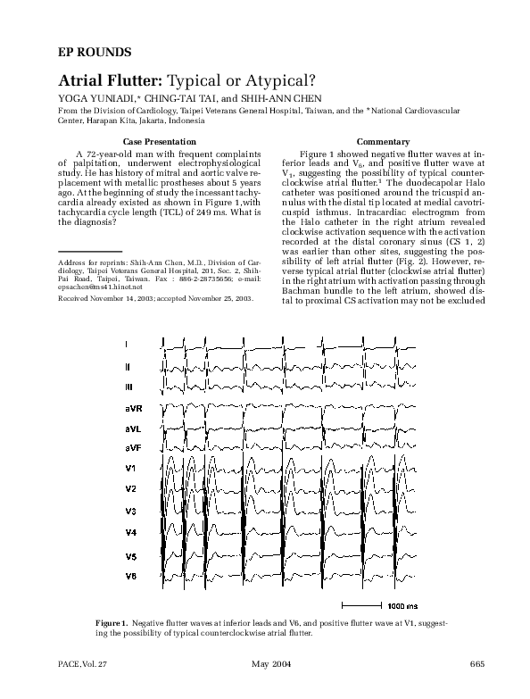 (PDF) Atrial Flutter:. Typical or Atypical?