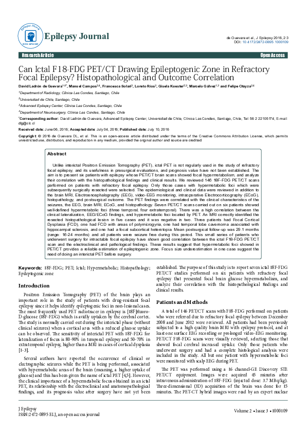 (PDF) Can Ictal F18-FDG PET/CT Drawing Epileptogenic Zone in Refractory ...