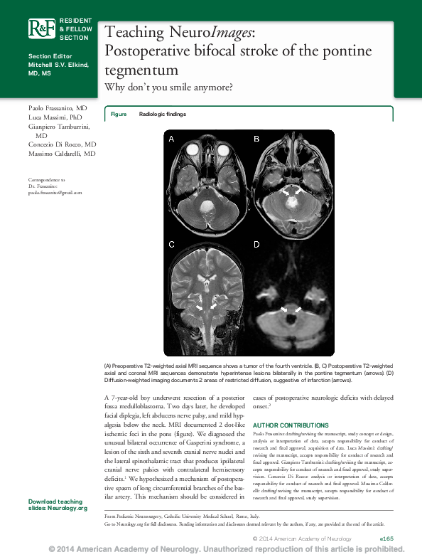 (PDF) Teaching NeuroImages: Postoperative bifocal stroke of the pontine ...