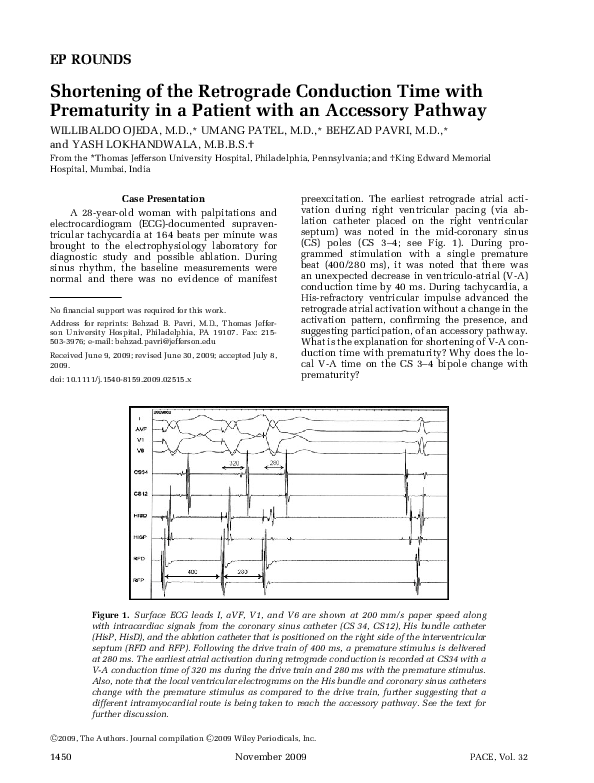 (PDF) Shortening of the Retrograde Conduction Time with Prematurity in ...
