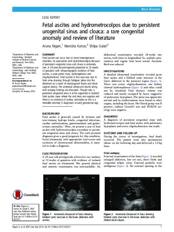 (PDF) Fetal ascites and hydrometrocolpos due to persistent urogenital ...