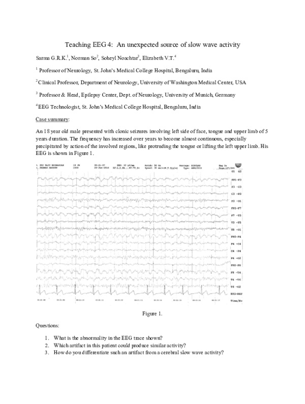 (PDF) Teaching EEG 4: An unexpected source of slow wave activity