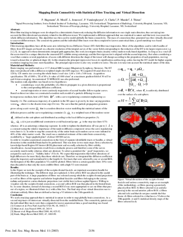 (PDF) Mapping Brain Connectivity with Statistical Fibre Tracking and ...