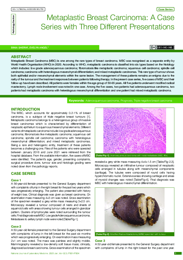 (PDF) Metaplastic Breast Carcinoma: A Case Series with Three Different ...