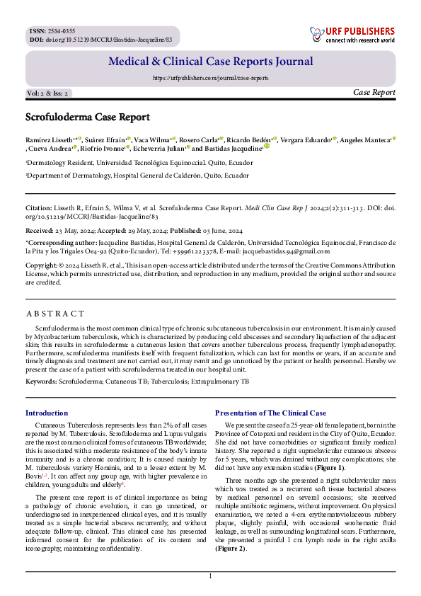 (PDF) Scrofuloderma Case Report