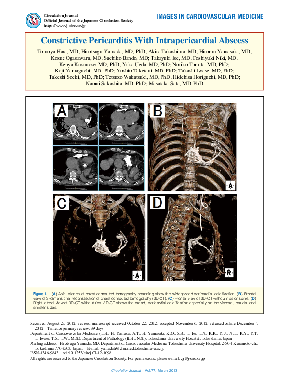 (PDF) Constrictive Pericarditis With Intrapericardial Abscess
