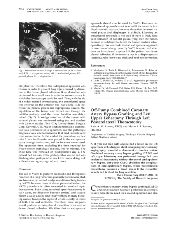 (PDF) Off-pump combined coronary artery bypass grafting and left upper ...