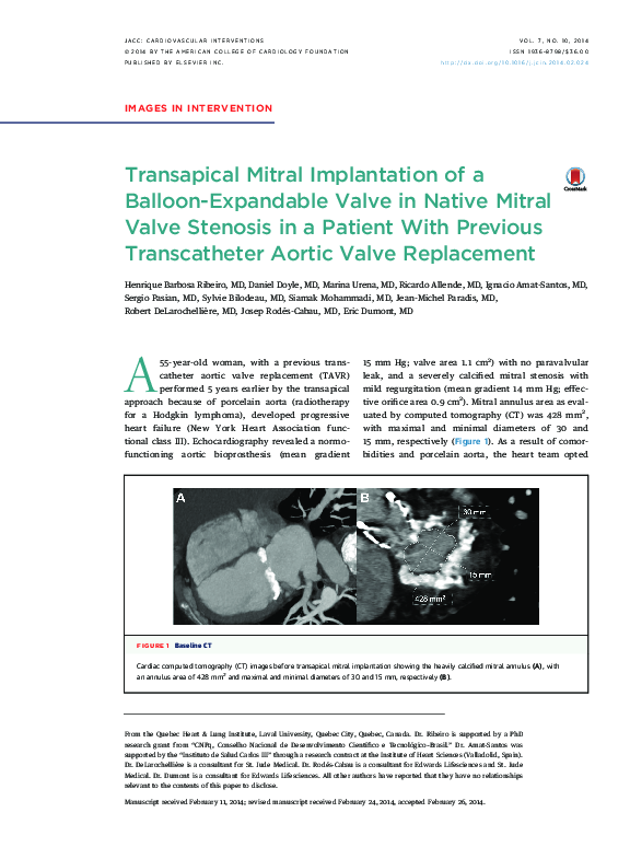 (PDF) Transapical Mitral Implantation of a Balloon-Expandable Valve in ...