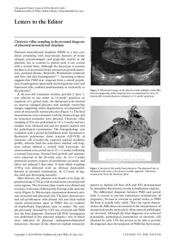 (PDF) Chorionic villus sampling in the prenatal diagnosis of placental ...