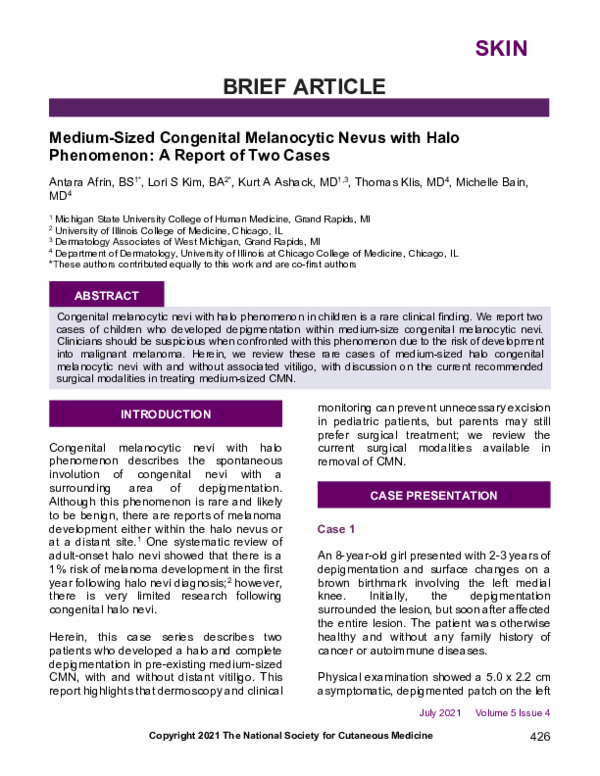 (PDF) Medium-Sized Congenital Melanocytic Nevus with Halo Phenomenon: A ...