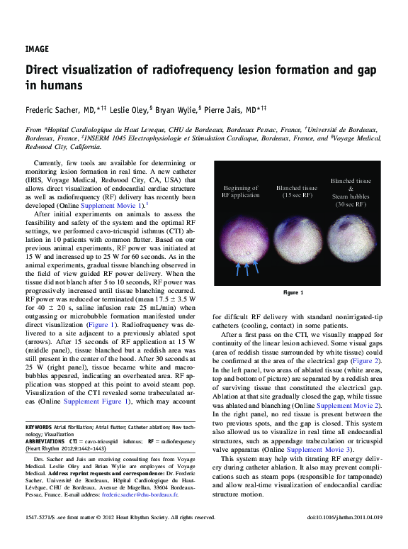 (PDF) Direct visualization of radiofrequency lesion formation and gap ...