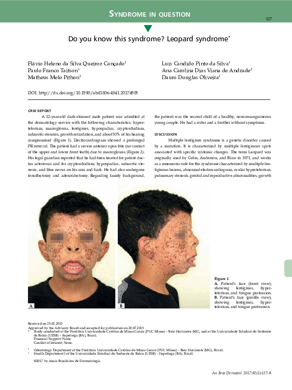 (PDF) Do you know this syndrome? Leopard syndrome
