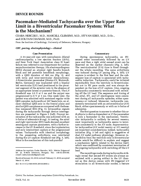 (PDF) Pacemaker-Mediated Tachycardia over the Upper Rate Limit in a ...