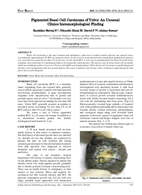 (PDF) Pigmented Basal Cell Carcinoma of Vulva: An Unusual Clinico ...