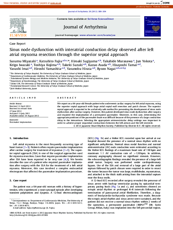 (PDF) Sinus node dysfunction with interatrial conduction delay observed ...