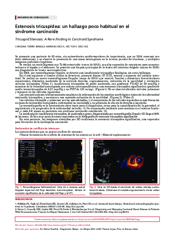 (PDF) Tricuspid Stenosis: A Rare Finding in Carcinoid Syndrome