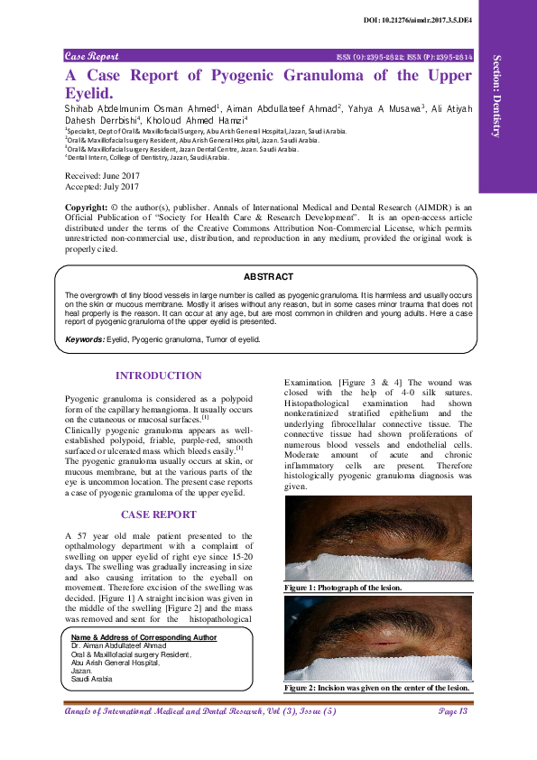 (PDF) A Case Report of Pyogenic Granuloma of the Upper Eyelid