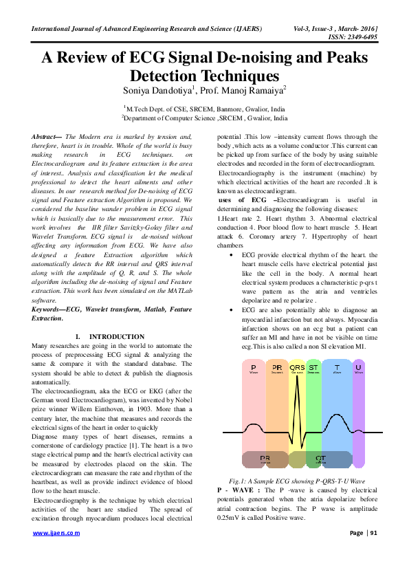 (PDF) A Review of ECG Signal De-noising and Peaks Detection Techniques