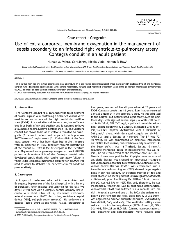 (PDF) Case report - Congenital Use of extra corporeal membrane ...