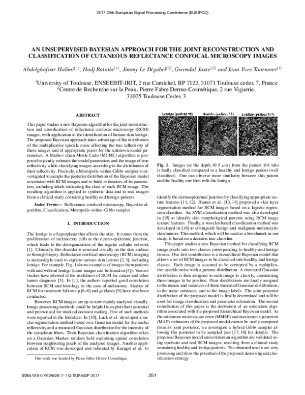 (PDF) An unsupervised Bayesian approach for the joint reconstruction ...