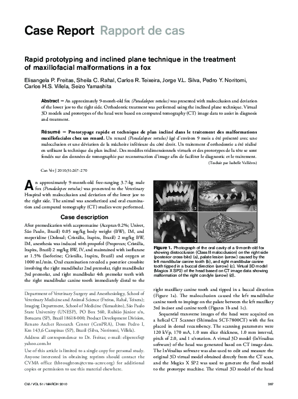 (PDF) Rapid prototyping and inclined plane technique in the treatment ...
