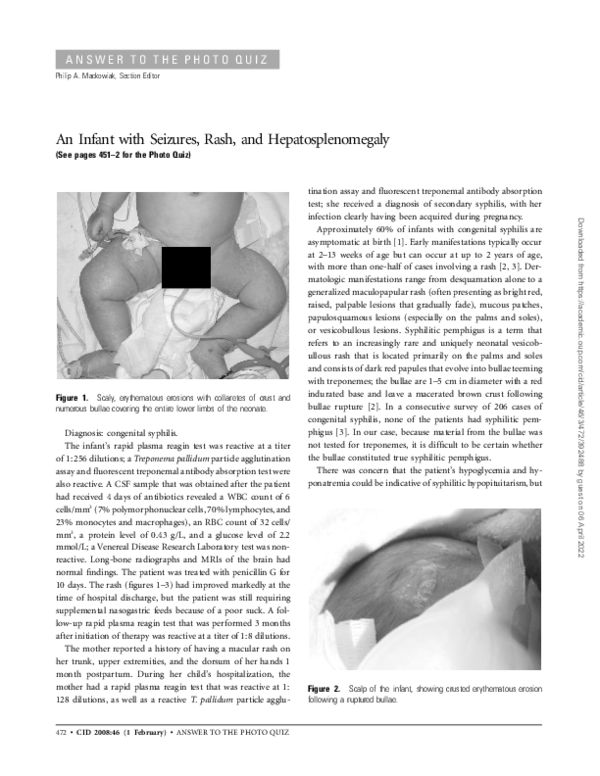 (PDF) An Infant with Seizures, Rash, and Hepatosplenomegaly