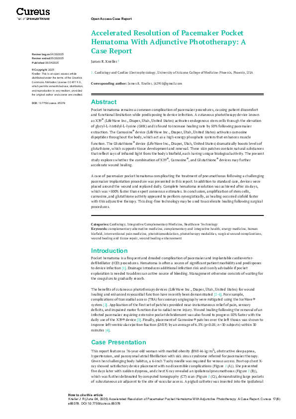 (PDF) Accelerated Resolution of Pacemaker Pocket Hematoma With ...