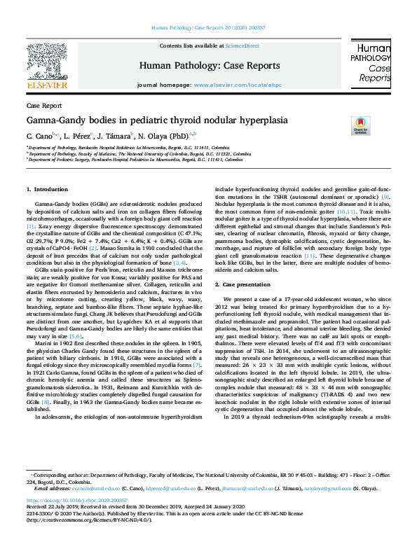 (PDF) Gamna-Gandy bodies in pediatric thyroid nodular hyperplasia